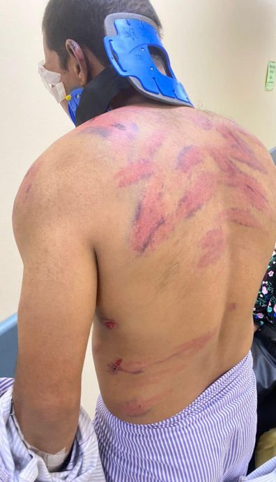 戒毒者遭殴打 左眼被打瞎!警方捕2员工助查