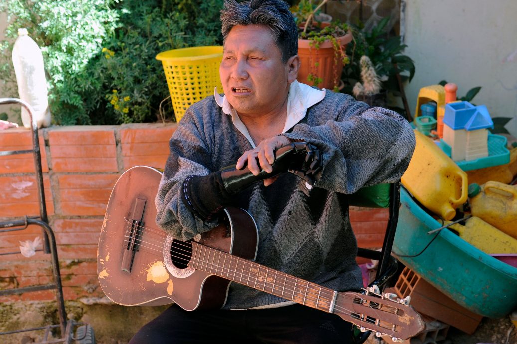 暖势力/玻利维亚玩具匠人用3D打印义肢 为失去肢体者重拾尊严