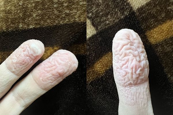 泡澡爆睡5小时！他手指“皱成蕈菇”超恶画面曝　痛到无法穿衣服