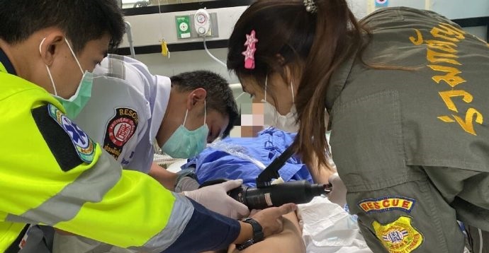 生殖器套11铁环肿胀 男子痛到昏迷送医