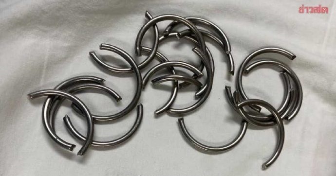 生殖器套11铁环肿胀 男子痛到昏迷送医