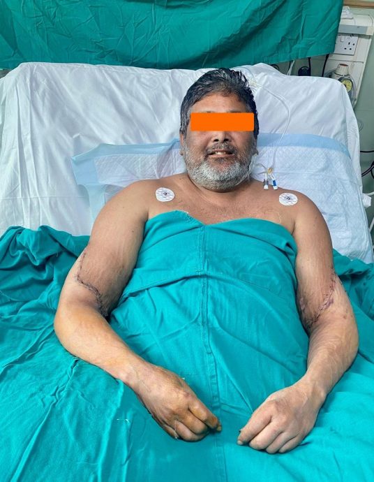 男遭火车撞上断手 等4年终等到“双臂器捐”12小时手术接回