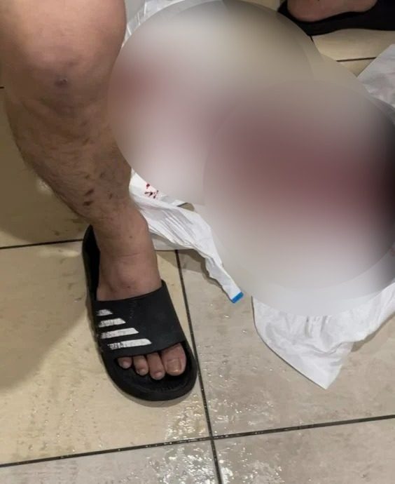 痛!男子尿道拔管受伤出血 “医护人员粗鲁拒道歉”