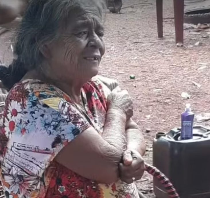 胎死腹中56年 81岁奶奶肚痛就医“惊见石胎