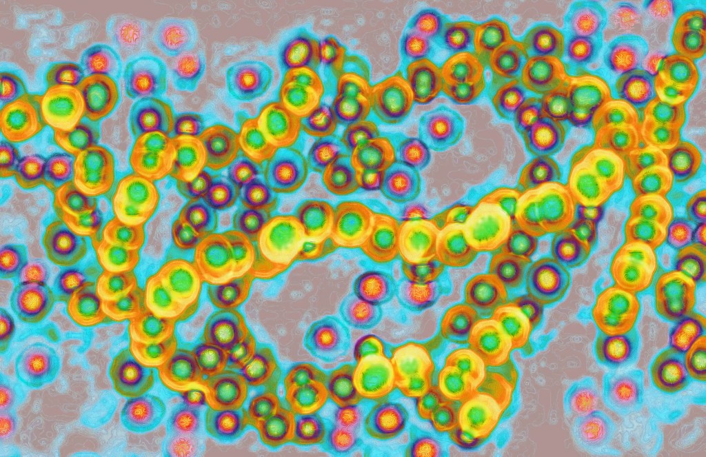 致死率高达30% 日本毒性休克症候群案例激增 原因成谜