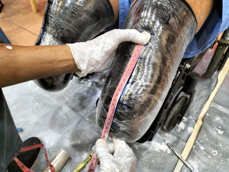 (大北马)槟德教会紫云阁第6届免费装置义肢活动