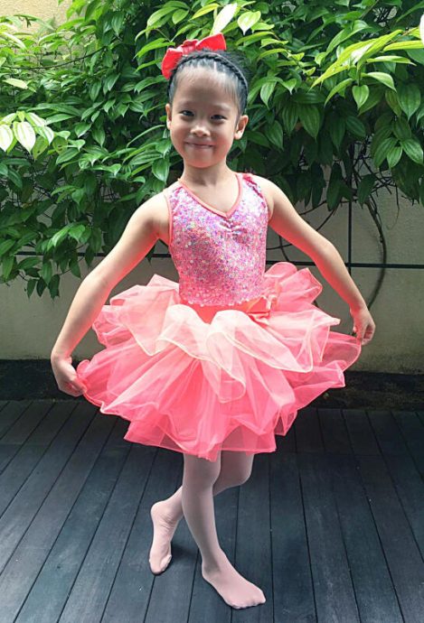 (已签发)柔:狮城二三事:不畏湿疹发炎 女童学舞逐梦许