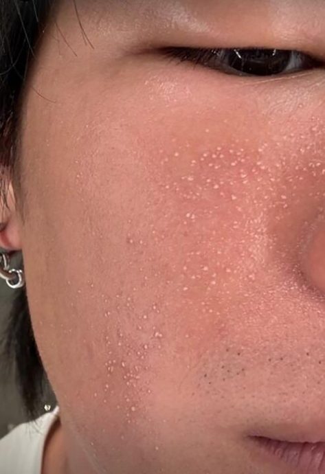 （已签发）柔：狮城二三事：出席巴黎活动敏感入院没好转　容启航返新检查