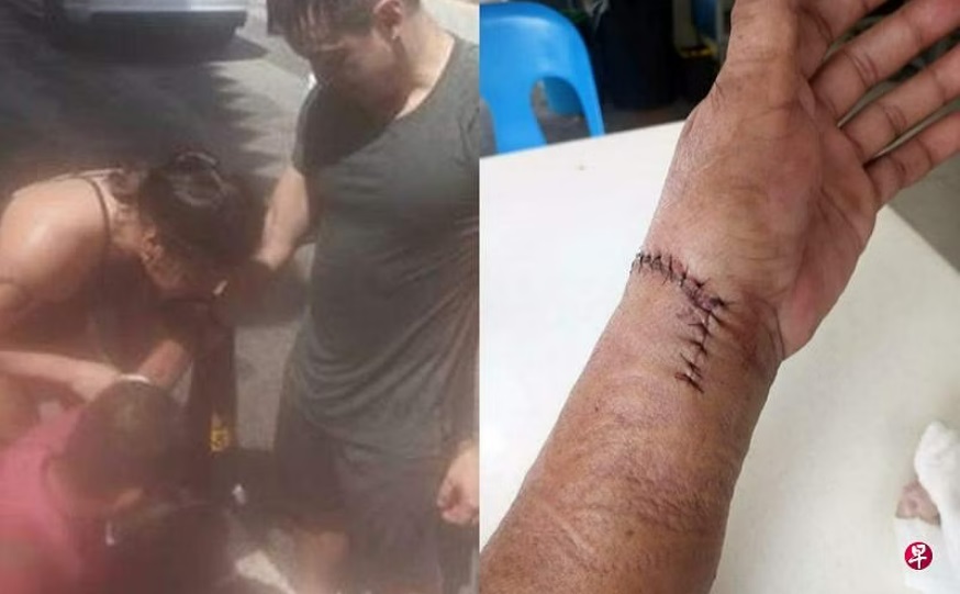 （已签发）柔：狮城二三事：男子割伤手血流不止，路过女医生及时救援