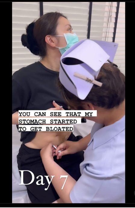 JW王灏儿自曝冻卵过程 10天打21支排卵针:值得