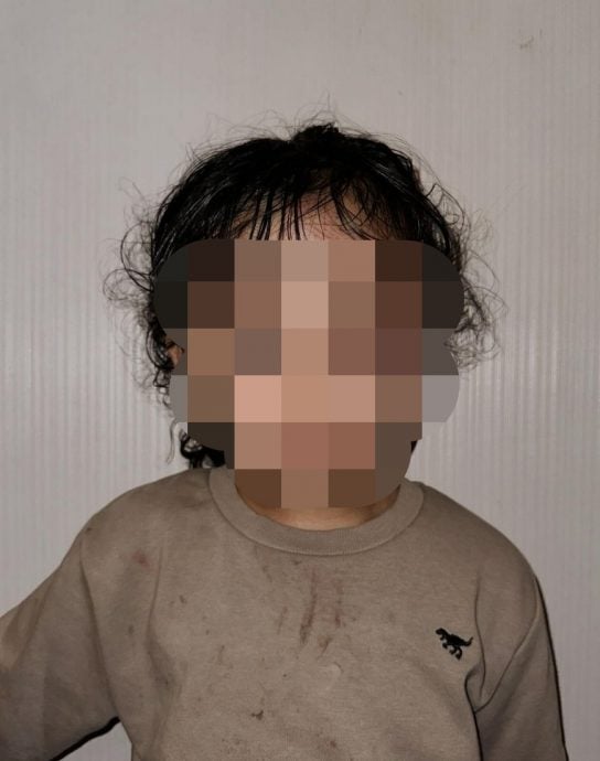 印尼网红4岁女遭保姆虐打 眼睛耳朵严重淤青