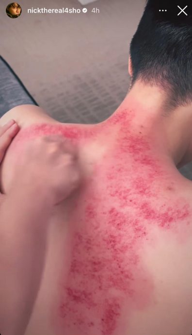 周汤豪开唱前去刮痧 妈妈比莉被曝也在大马