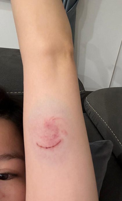 **已签发**柔:狮城二三事:一口咬住女郎手臂,狮城自然公园现恶猴