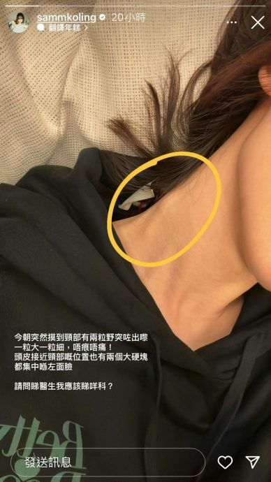 月初曝颈部有硬块 高海宁突晒入院照