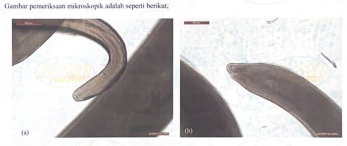 柔：沙丁鱼罐头无准证入口遭扣查，检验发现罐头含异尖线虫