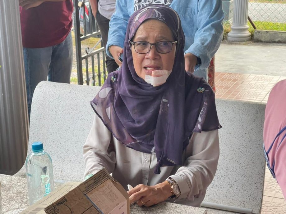 柔:车子失控撞路边,兴楼州议员艾薇雅车祸,嘴巴下巴缝19针