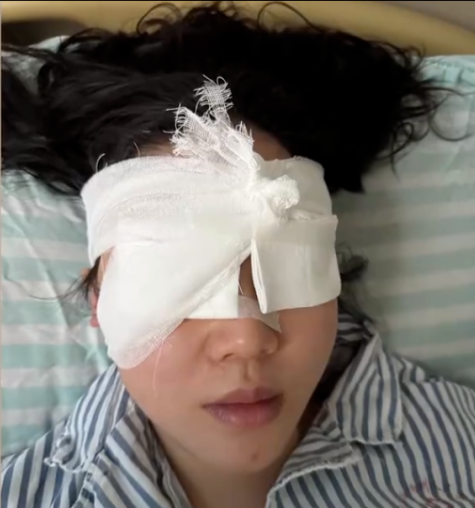 泼水节被高压水枪射伤 女游客右眼一度失明