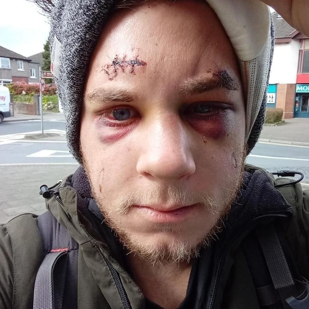 看世界)讲「外语」惹祸? 两男被指欠尊重遭围殴 1死1重伤