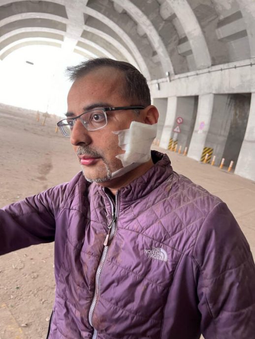 (已签发)柔:狮城二三事:狮城工作夫妻困九曲洞步道24小时 夫被碎石割伤脸