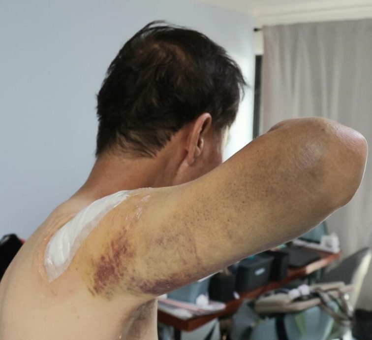 (已签发)柔:狮城二三事:狮城淡滨尼致命车祸:货车司机:遭猛烈撞击差一寸就是我 侥幸捡回一命