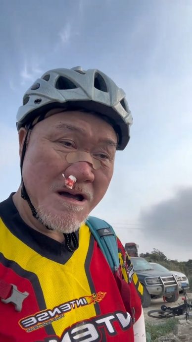 TVB御用恶人70岁生日前夕出意外 骑脚车摔伤鼻樑