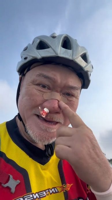 TVB御用恶人70岁生日前夕出意外 骑脚车摔伤鼻樑