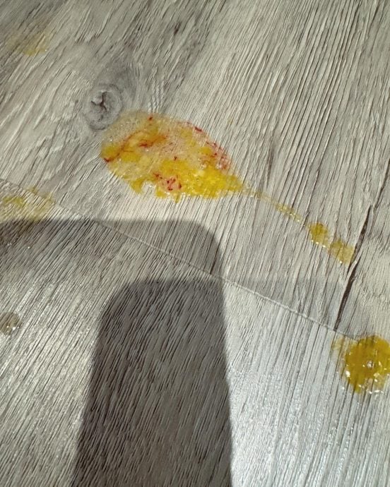 10个月大女儿误吞别针线丢命 许维恩吓疯认最失败父母