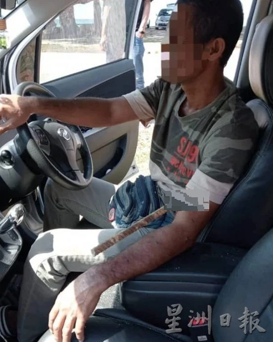 东:天降横祸 铁条从罗里掉下穿透车镜刺穿司机手臂肋骨