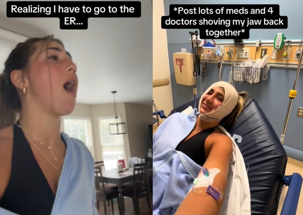 打哈欠太用力掉下巴　4医花4小时推回原位