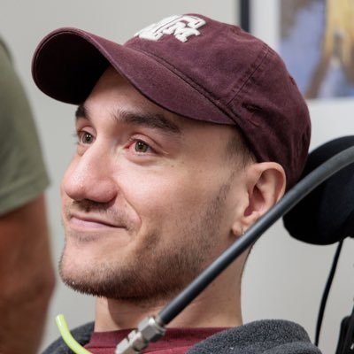 首例患者植入大脑晶片数月 Neuralink系统出现故障