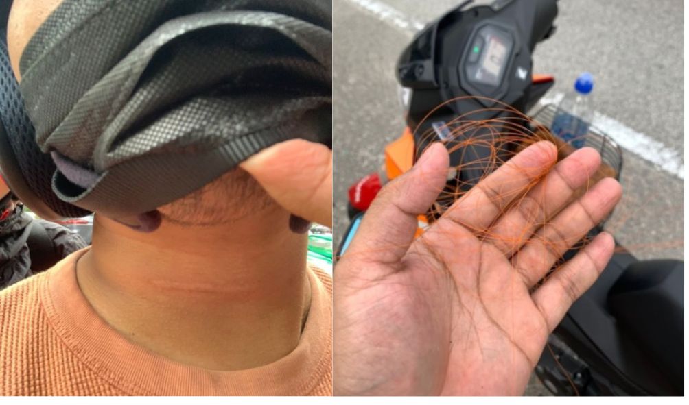 骑行遭不明线割伤下巴 事主:SUKE已联系我!