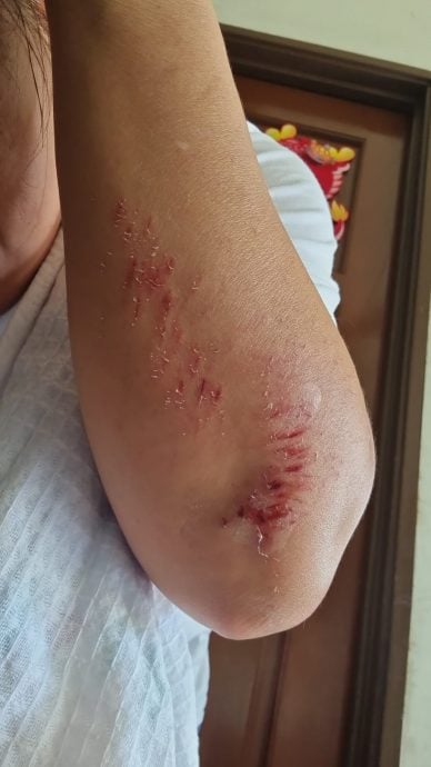 (已签发)柔:民生特工队:柔佛花园蓄水池公园毛病丛生,居民盼望改善提升