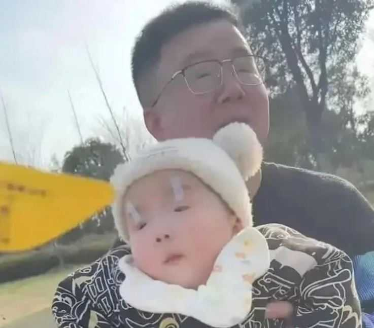 儿子眼睛小… 网惊:赶快带去看医生