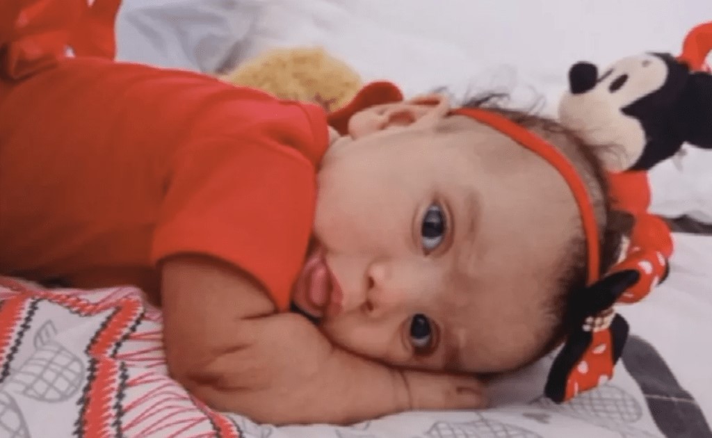 巴西家犬饿疯钻洞逃离围栏 拖5月大女婴到后院撕咬致死