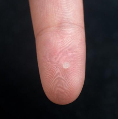 拼盘/科研人员研发微型传感器 可注入体内并降解