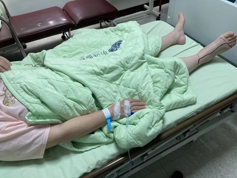 毒蛇藏洗衣机下 妇女脚踝被咬 家属拍照救回一命