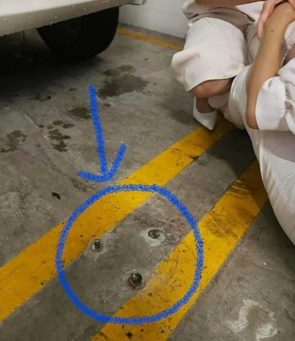  被螺丝绊倒胸部骨折 崔月欢：庆幸没穿高跟鞋