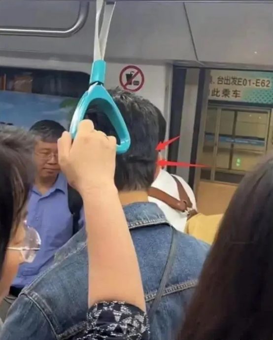 黄晓明戴假发搭地铁？僵笑被疑医美过度