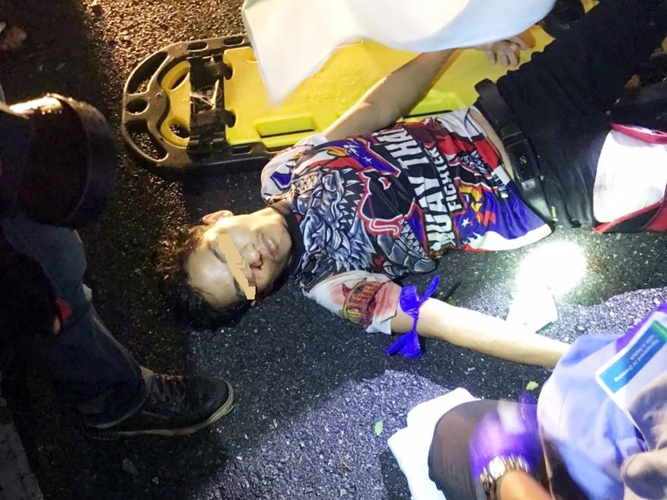 凌晨暴风雨席卷玻，大树被连根拔起，年轻夫妻骑士回家被压，少妇腰骨折胎死腹中，夫左腿骨折