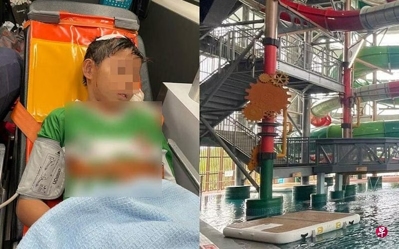 (已签发)柔:狮城二三事:9岁童水上乐园玩跳水撞破头 伤深见骨缝7针