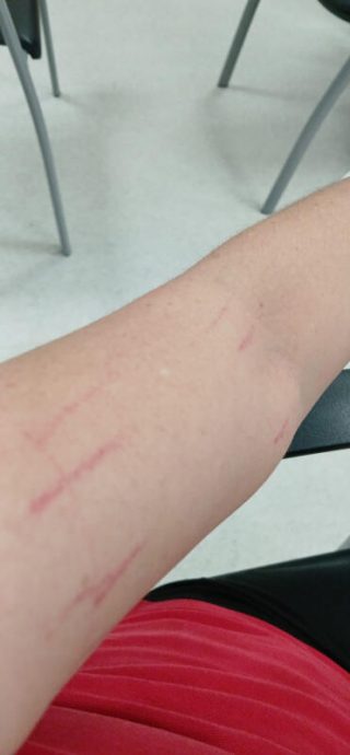 （已签发）柔：狮城二三事：疑2啤酒女闹不和　酒客护花大打出手