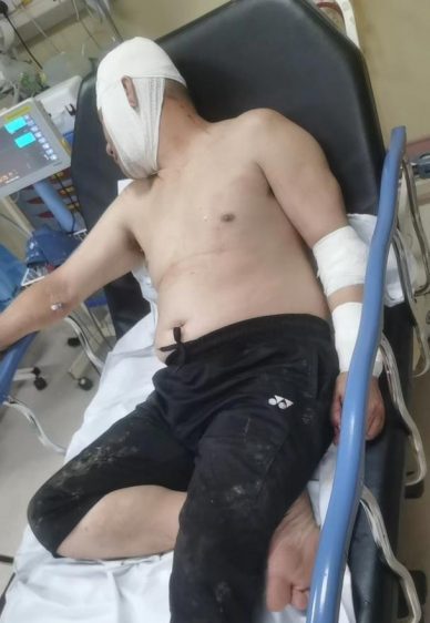 全国:12窃匪偷榴梿又砍人,芭主头破血流送院