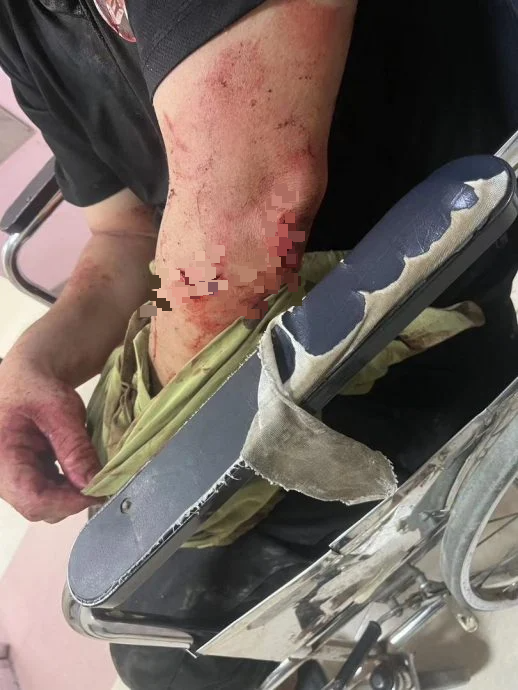 全国:12窃匪偷榴梿又砍人,芭主头破血流送院