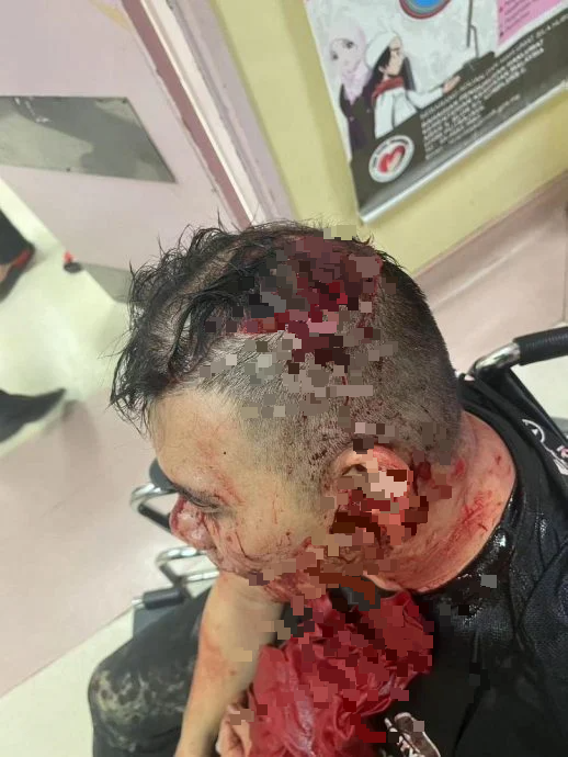 全国:12窃匪偷榴梿又砍人,芭主头破血流送院