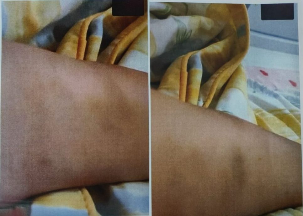 投诉遭霸凌反被老师针对 家长报警兼为孩子转校