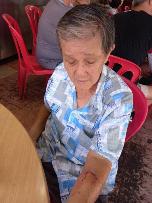 柔:76岁老人遭精神失常大儿子击伤