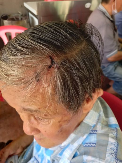 柔:76岁老人遭精神失常大儿子击伤