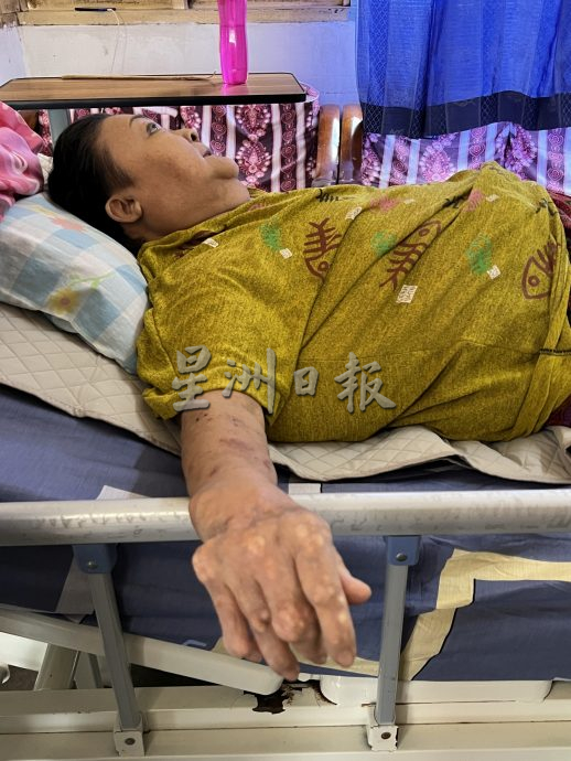 (古城版封面主文) 妇人截肢孩子辞工照顾·盼公众伸出援手