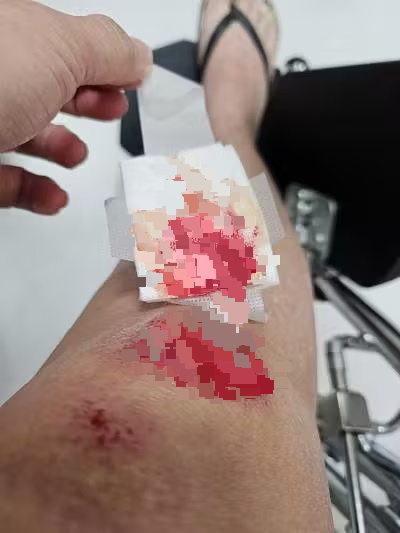 (已签发)柔:狮城二三事:公寓外提醒个人代步工具骑士减速 女会计遭数人围殴