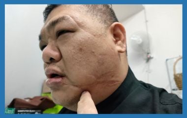 校园霸凌（三）| 恶魔心魔单独变狗熊 “Komtar Boy”现身说法